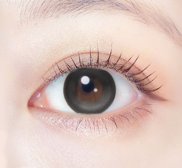 إسقاط الطفل | 1 شهر