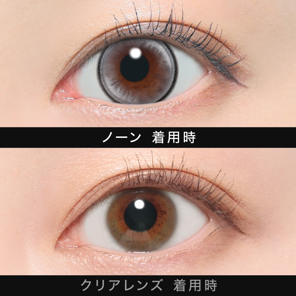 NONE [ØTHER] | 1day 